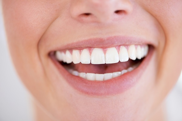 Reasons To Consider Zoom Teeth Whitening